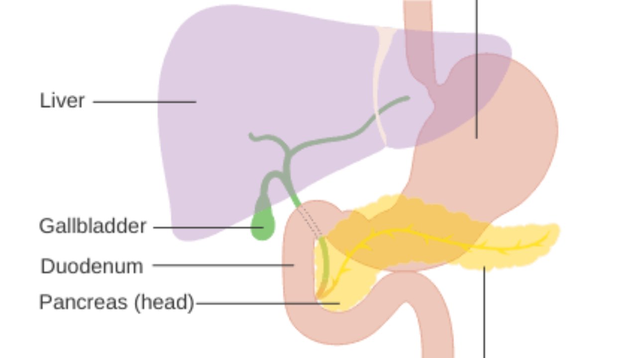 Acute Pancreatitis Meaning In Marathi