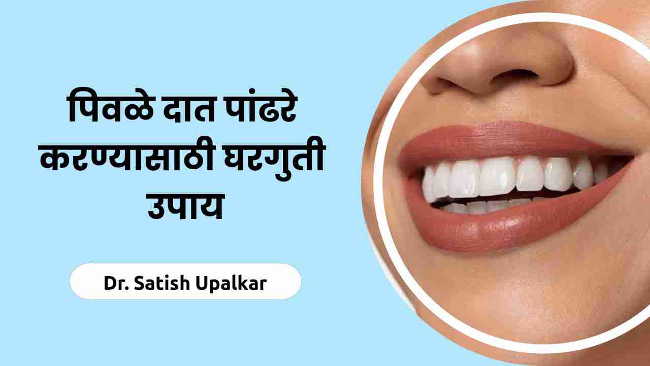 पिवळे दात पांढरे करण्याचे 6 सोपे उपाय Teeth Whitening tips