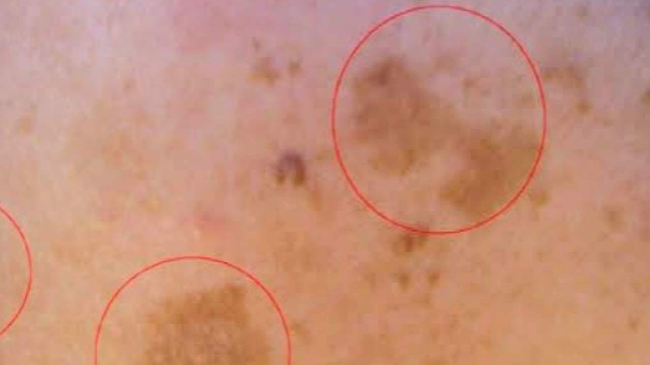 dark-spots-on-skin