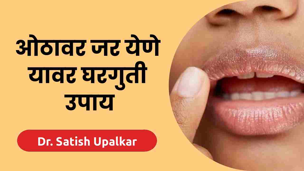 ओठांवर जर येण्याची कारणे व उपाय 